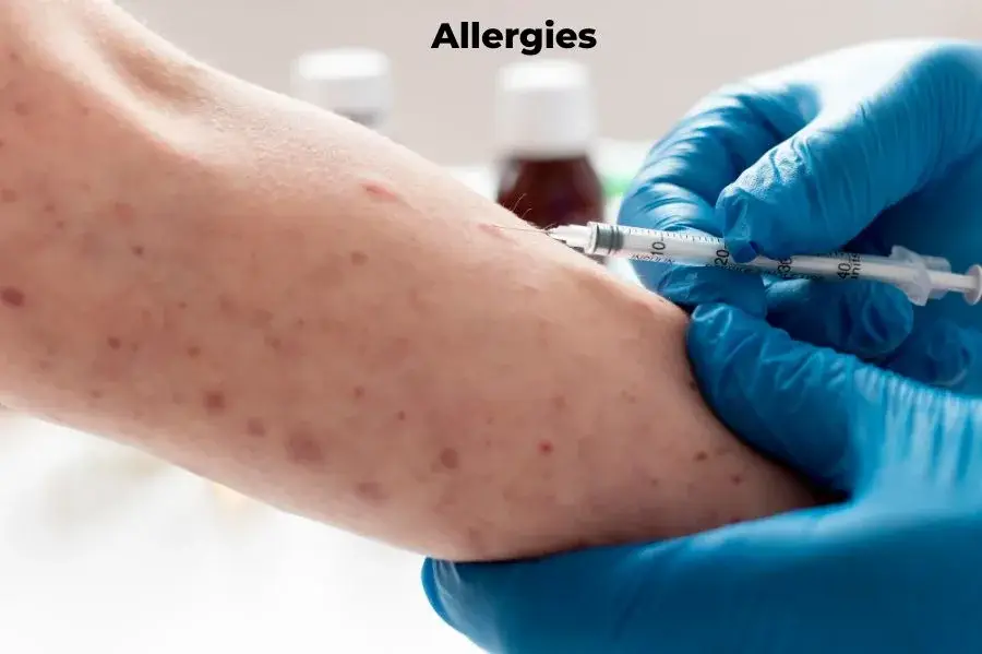 “Latex Allergy: Understanding the Risks and Types (2024)”: - ntrblog.online